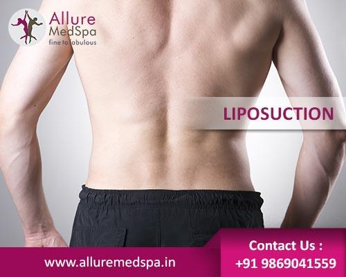 Liposuction in Mumbai