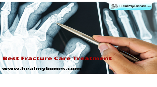 Heal My Bones: Best Treatment for Bone Fracture in Kolkata