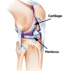 Heal My Bones: Renowned Orthopedic Surgeon For Knee Replacement