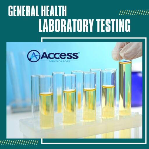 Importance of Urine Test for Health and Wellness