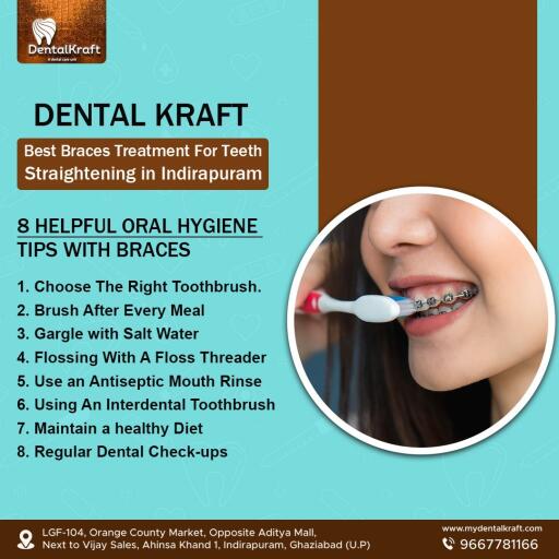 Best Braces Treatment for Teeth Straightening in Indirapuram
