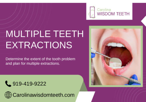 Efficient Tooth Extraction Service