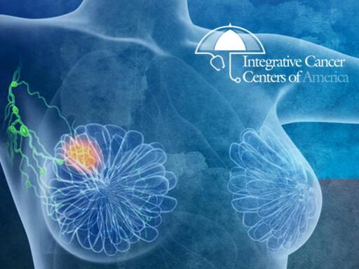 Comprehensive Breast Cancer Treatment Center | Integrativecancercentersofamerica.com