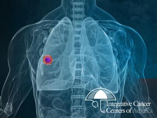 Non-small Cell Lung Cancer Treatment in Baja California | Integrativecancercentersofamerica.com