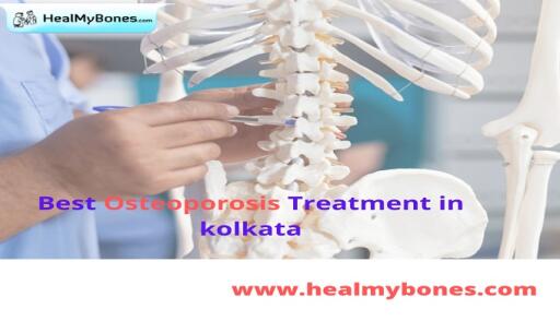 Heal My Bones: Best Osteoporosis Treatment in Kolkata
