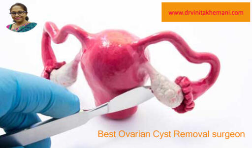 Dr. Vinita Khemani: Most Trusted Ovarian Cysts Removal Surgeon in Kolkata