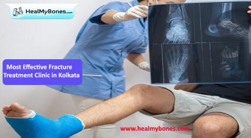 Heal My Bones: Best Treatment for Fracture in Kolkata
