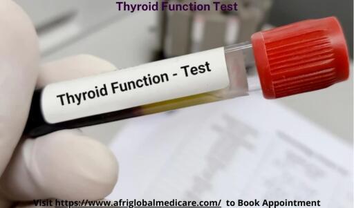 Thyroid Function Test in Nigeria