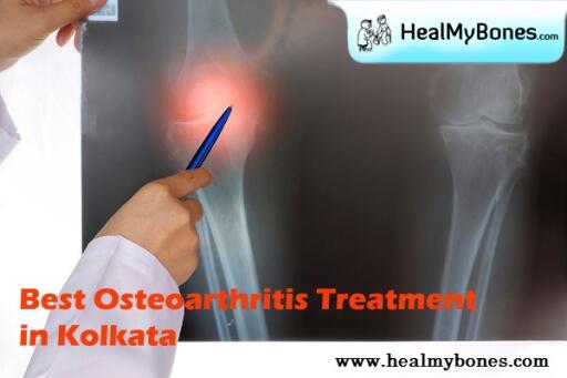 Heal My Bones: Top Quality Treatment for Osteoarthritis in Kolkata
