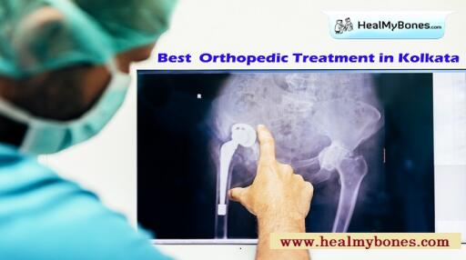 Heal My Bones: High Rated Orthopedic Treatment in Kolkata