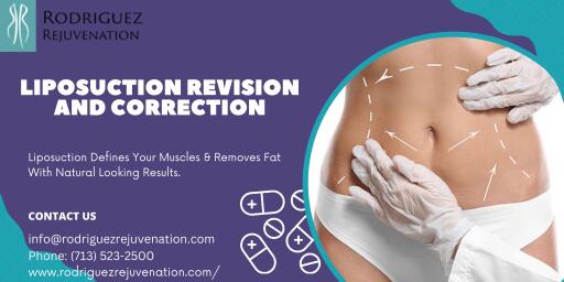 Widely recognized Liposuction Doctors in Houston- Dr. Rodriguez