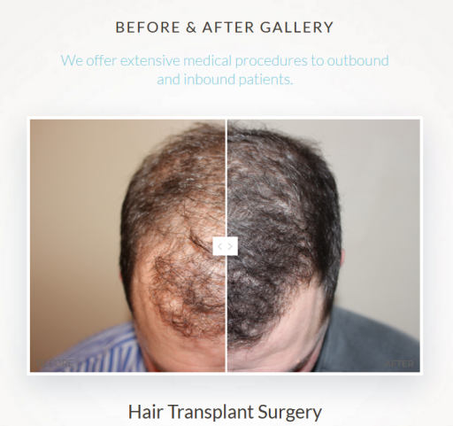 Hair Transplant Plantation - South Florida Hair Institute (954) 472-8355